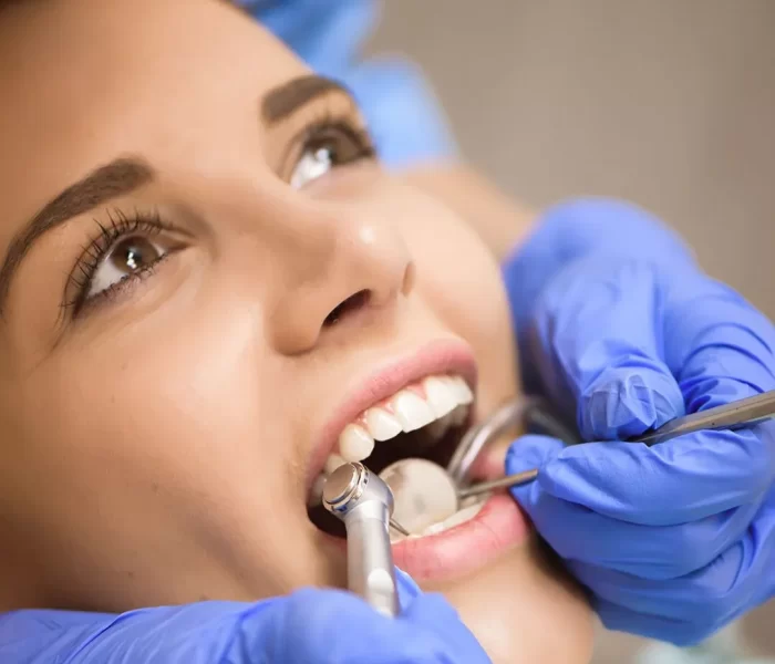 tooth-extraction-in-dubai